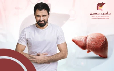 اعراض المرحلة الاخيرة لمريض الكبد وكيفية التعامل معها