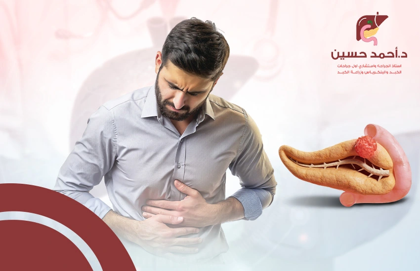 اعراض سرطان البنكرياس المرحلة الاخيرة