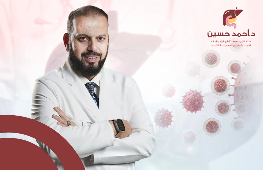 افضل دكتور أورام في مصر | الدكتور أحمد حسين