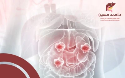 هل ظهور أي ورم في البطن يستدعي القلق والذعر؟