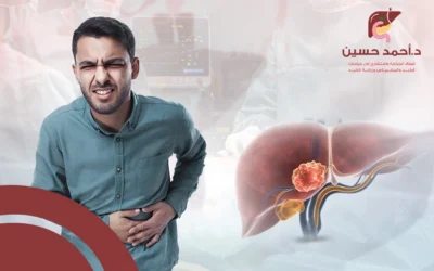 تعرف إلى أعراض سرطان القنوات المرارية