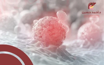 تعرف إلى قصة حالة نادرة تعافت من ورم الساركوما الشحمية مع دكتور أحمد حسين