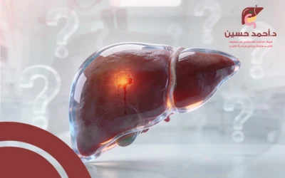 كل ما تود معرفته عن نزيف الكبد من أسباب وأعراض وكيفية العلاج