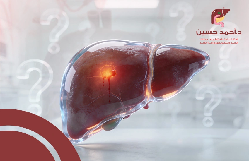 كل ما تود معرفته عن نزيف الكبد من أسباب وأعراض وكيفية العلاج